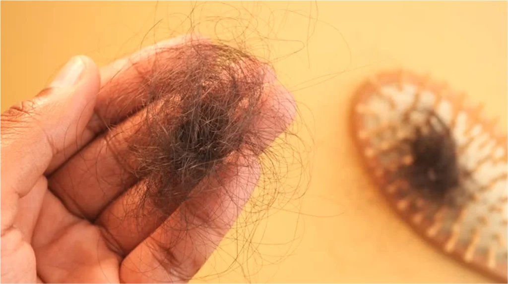 Early hair loss treatment consultation for healthier hair